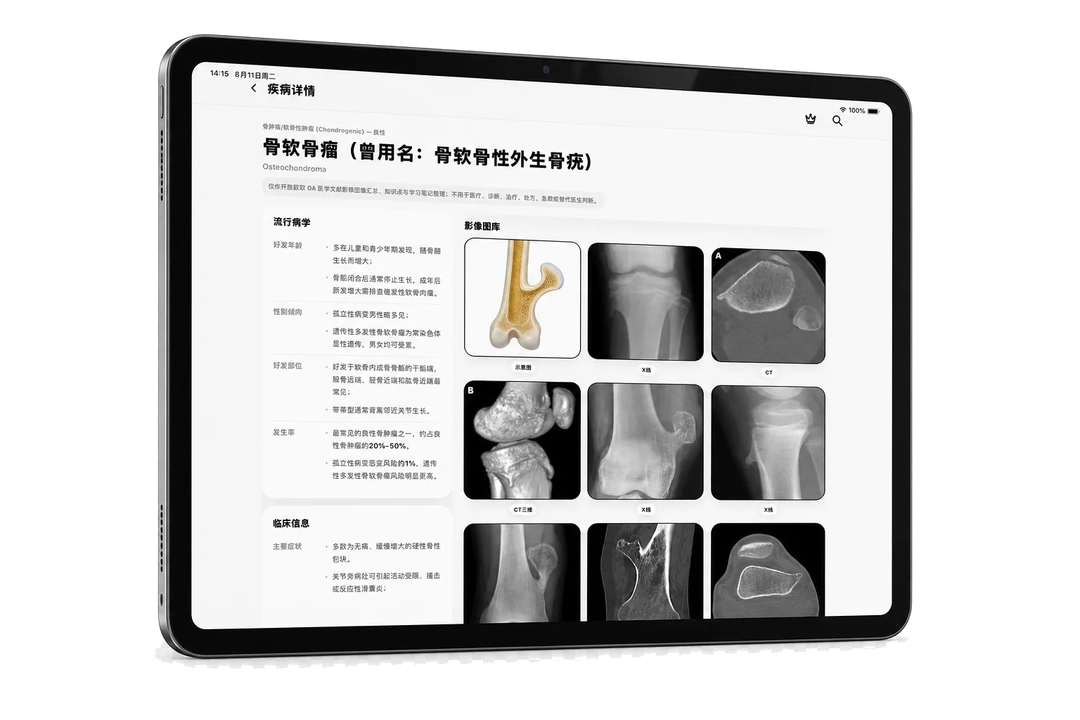 知影 iPad 疾病详情界面